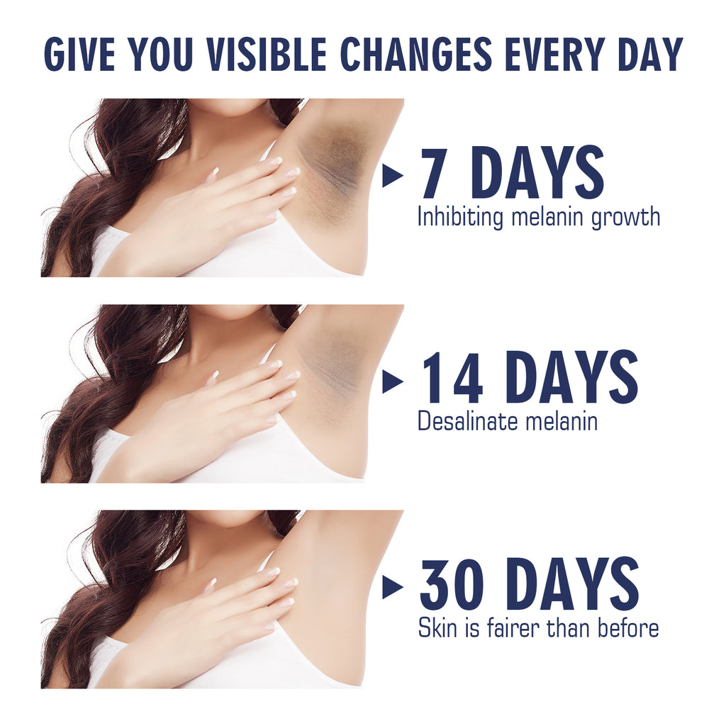 OUHOE Underarm Care Cream Knee Knuckle Elbow Armpit Dull Moisturizing Cleansing Skin Beauty Cream